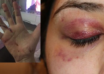 Genç kadını darp etti, ‘Pide yaptırayım mı?’ diye mesaj attı