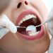 Diş tedavinizi ertelemeyin; daha büyük hastalıklara neden olabiliyor