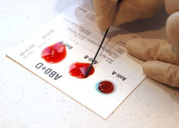 Kan grubu Covid-19’da etkili mi?