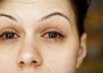 Diyabet kalıcı körlük sebebi olmasın! Diyabette göz sağlığı için bunlara dikkat