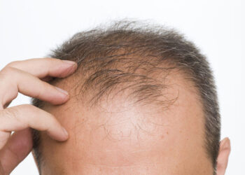 Kel erkeklerin koronaya yakalanma ihtimali 2,5 kat fazla