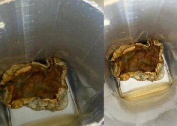 Kutu içecekler hakkında uyarı: ‘Ameliyatla çıkarılabilecek duruma kadar gidebilir’