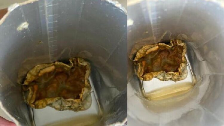 Kutu içecekler hakkında uyarı: ‘Ameliyatla çıkarılabilecek duruma kadar gidebilir’