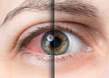 Mevsimsel alerjilerde hastaları bekleyen büyük tehlike: Kalıcı kayıplara neden olabilir