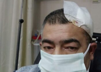 İmamdan müezzine öldüresiye dayak