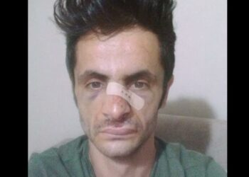 Maske takma uyarısında bulundu, darp edildi