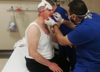 MHP Genel Merkezi ile ters düşen Ülkücü isme evinin önünde saldırı