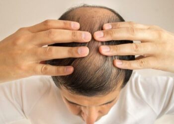 ‘Corona virüs hastalarında saç dökülmesi görülüyor’