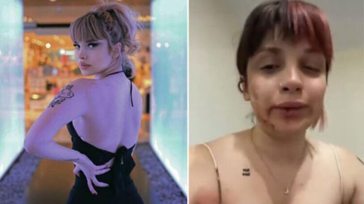 Sosyal medya fenomeni Başak Ermiş, tayt giydiği için öldüresiye dövüldü!