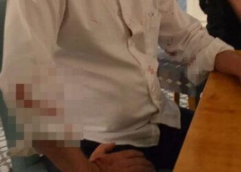 Didim Belediye Başkanı Deniz Atabay’a saldırıda yeni gelişme