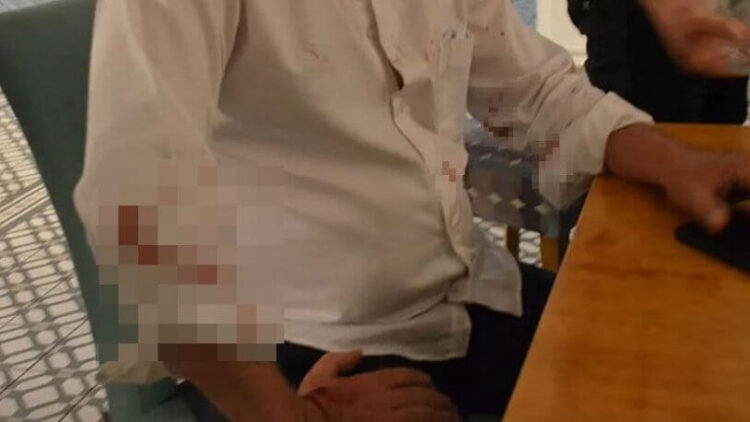 Didim Belediye Başkanı Deniz Atabay’a saldırıda yeni gelişme