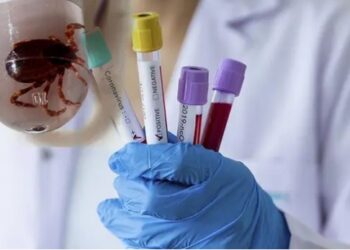 Türkiye’de bir ilk! Koronavirüsle birlikte görüldü…