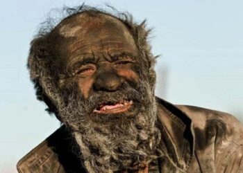 65 yıldır yıkanmayan adam görenleri şaşkına çeviriyor