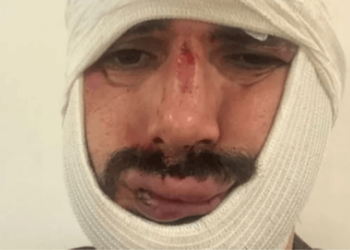 Anadolu Ajansı muhabirine öldüresiye dayak