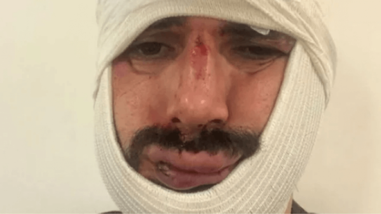 Anadolu Ajansı muhabirine öldüresiye dayak