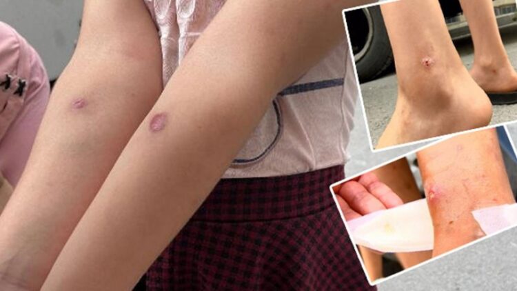 İstanbul’da sivrisinek kabusu