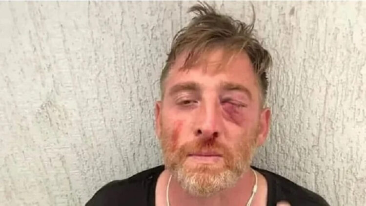 LGBTİ+ karşıtlarının dövdüğü kameraman hayatını kaybetti