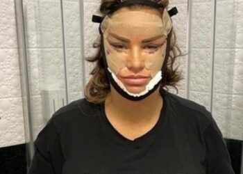 Ünlü isim estetiğe doymadı, eşi isyan etti