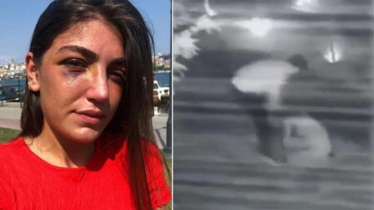 Manken Gizem Akbaş’ı öldüresiye döven eski sevgilisi tutuklandı