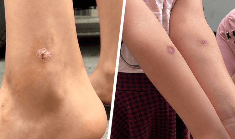 İstanbul’da tehlike: ‘Ölümcül hastalıklar bulaşabilir uyarısı’