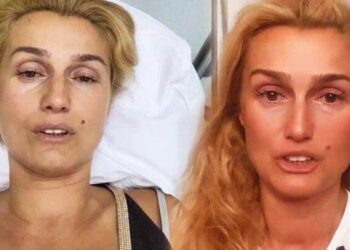 Özay ölen atıyla fotoğraf paylaştı: Yaktığınız yerde yanacaksınız