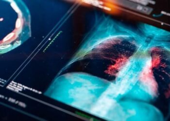 Doktorlar koronavirüs sandı ama gerçek bambaşka çıktı