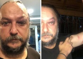 Sanatçı Güvenç Dağüstün’e konser sonrası saldırı