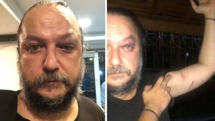 Sanatçı Güvenç Dağüstün’e konser sonrası saldırı