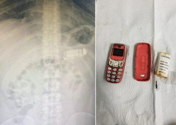 Midesinden Nokia 3310 çıktı