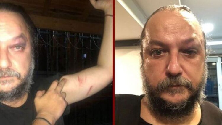 Güvenç Dağüstün’e saldıranlar yakalandı