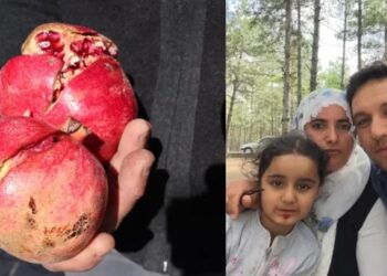 Nar yedikten sonra ölen çocukla ilgili adli tıp raporu