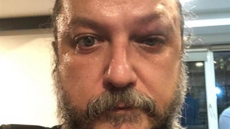 Güvenç Dağüstün’e saldıran iki kişi gözaltına alındı