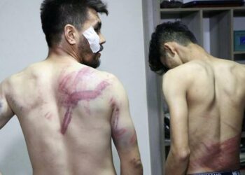 Kadınların protestosunu haber yapan gazetecilere işkence