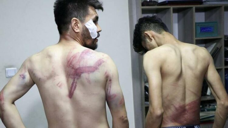 Kadınların protestosunu haber yapan gazetecilere işkence