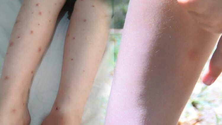 İstanbul’un kâbusu olmuştu! İBB harekete geçti