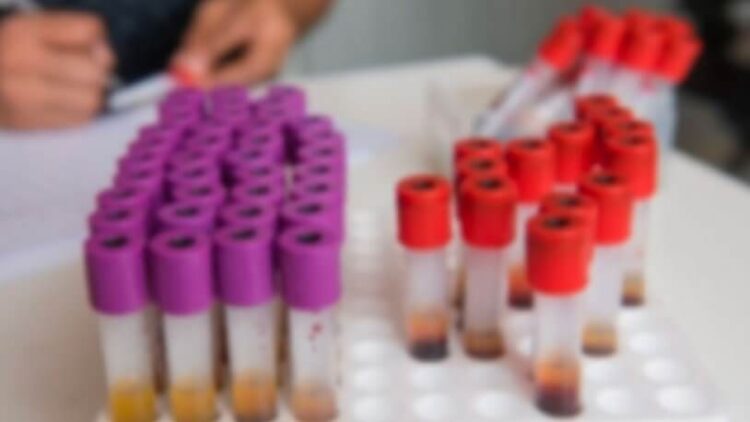 Sağlık Bakanlığı’ndan SMA kararı: 81 ilde yapılacak