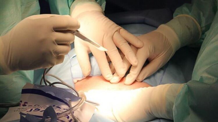 Domuz böbreğinin insana nakli helal mi, haram mı?