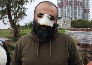 ‘Bir şey yapmaz’ denilen pitbull, burnunu kopardı