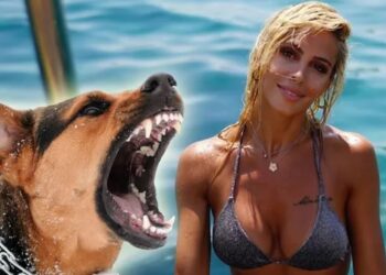 Survivor Duygu, beş köpeğin saldırısına uğradı