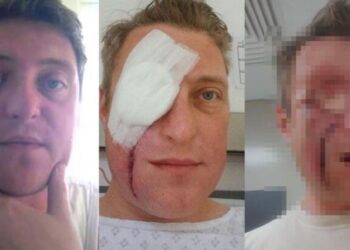 Enfeksiyon sanarak gitti, gerçek ortaya çıkınca şok oldu