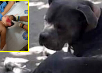 Pitbull dehşeti… 11 aylık bebeğin kulağını kopardı
