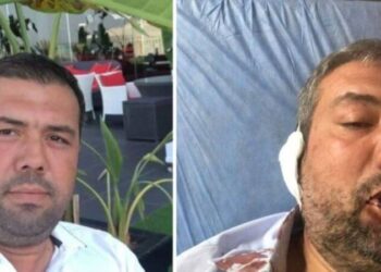 MHP’li belediye aleyhine paylaşım yapan yurttaşa çirkin saldırı