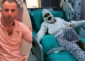 Sevgilisine kızgın yağ dökmüştü: İkinci karar verildi