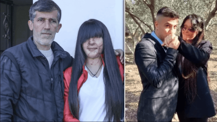 Yüzünü asitle yakan erkekle evlenen Berfin Özek’in babası konuştu