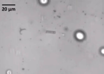 Araştırma: Korona virüsü sperm sayısı ve kalitesini düşürüyor