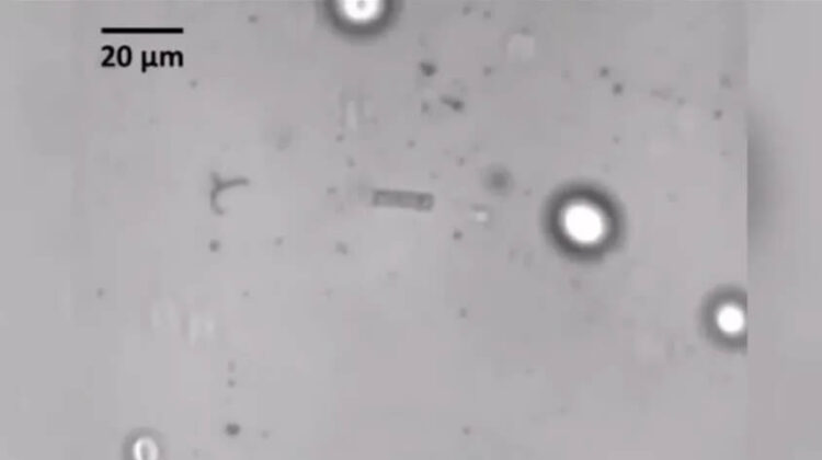 Araştırma: Korona virüsü sperm sayısı ve kalitesini düşürüyor