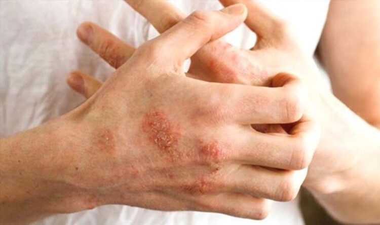 Dezenfektanlarla ilgili korkutan uyarı