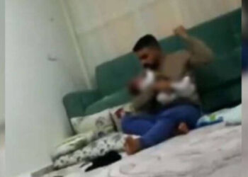 Babası tarafından darbedilen bebekten iyi haber