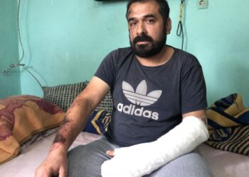 Yaralı madenci: Baret, lamba hiçbir şey kalmamıştı