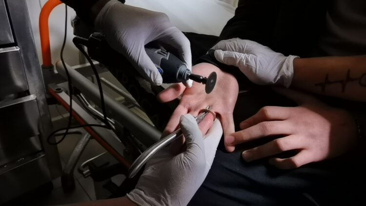 Bursa’da ilginç olay: Parmağına 1 TL sıkıştı